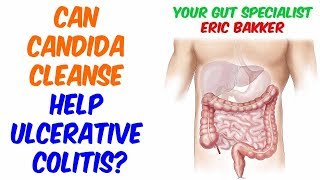 Is Candida Cleanse Good For Ulcerative Colitis [upl. by Nylessej]