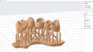 Impresión 3D de provisionales dentales [upl. by Yentrok]