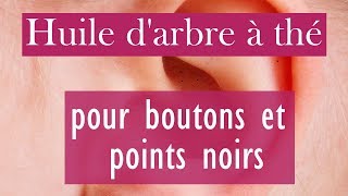 Huile darbre à thé pour boutons et points noirs [upl. by Demetre99]