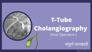 TTube Cholangiography Radiology in Hindi [upl. by Enamrahs]