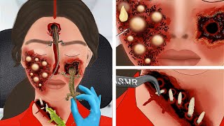 ASMR Treating a girl bitten by a lizard  ASMR Animation treatment  2D Animation [upl. by Aztinay]