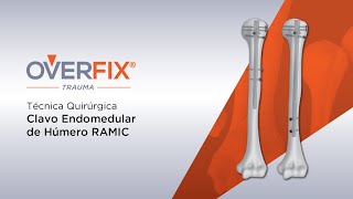 Técnica Quirúrgica Clavo Endomedular de Húmero Overfix RAMIC [upl. by Hu881]