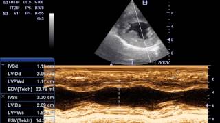 ECOCARDIOGRAFIA DOPPLER ESTENOSIS SUBAORTICA EN CANINOS IVAN ALVAREZ [upl. by Ikkir]