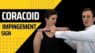 Coracoid Impingement Sign  Modified HawkinsKennedy Shoulder Impingement Test [upl. by Launamme300]