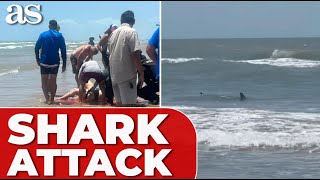 SHARK ATTACK in Texas DESTROYS womans leg leaves her hospitalized [upl. by Seema730]