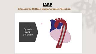 Cardiac ssist device IABP [upl. by Eeluj309]