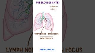 Clinical Cuts Mycobacterium tuberculosis [upl. by Ycrem]