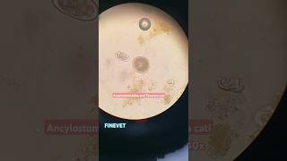 Ancylostomatidae and Toxocara cati hookworm roundworm cat microscope lab ancylostoma toxocara [upl. by Sayres]