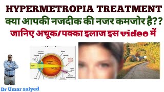 HYPERMETROPIA TREATMENT नजदीक की नजर कमजोर होना [upl. by Mochun819]