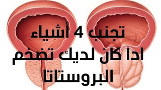 تجنب 4 أشياء إدا كان لديك تضخم البروستاتا [upl. by Ahsenat]