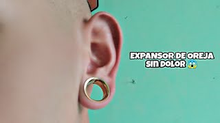 EXPANSOR CASERO SIN DOLOR [upl. by Couq405]