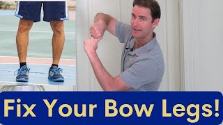 From BowLegged to Straight Legs The Ultimate Solution Revealed [upl. by Tankoos]