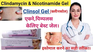 Clindamycin Phosphate and Nicotinamide Gel  Clinsol gel review in hindi  Clinsol gel uses in hindi [upl. by Ephrem752]