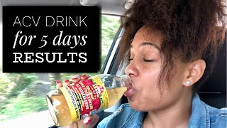 Lose Weight Fast with APPLE CIDER VINEGAR [upl. by Torrlow]