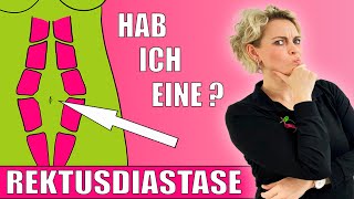 5 💜Anzeichen einer Rektusdiastase💜Wie erkenne ich ob ich eine Rectusdiastase habe💜habe ich eine💜 [upl. by Chung392]