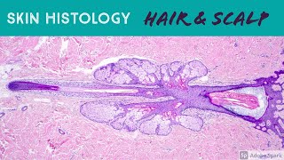 Hair follicle under microscope amp scalp skin histology dermatology dermpath pathology anatomy [upl. by Bisset]