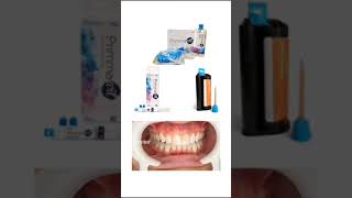 Bisacryl para puentes y coronas provisionales dentales [upl. by Eihpos]