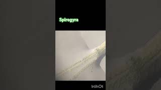 Spirogyra observation by microscope [upl. by Lenox]