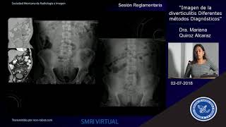 SESION REGLAMENTARIA  Imagen de la diverticulitis diferentes métodos Diagnósticos [upl. by Laersi]