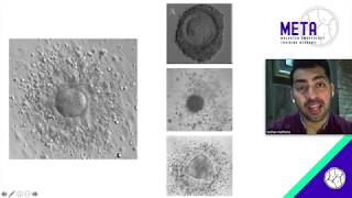 Oocyte factors to consider for embryo selection  Dr Keshav Malhotra [upl. by Fried]