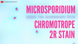 Microsporidium under the microscope with Chromotrope 2R stain [upl. by Lamrouex]