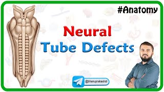 Neural Tube Defects Anatomy [upl. by Aloysius]