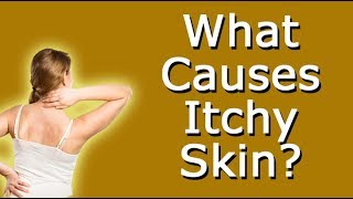 What Causes Itchy Skin [upl. by Ivz940]