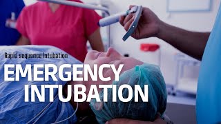 Emergency Intubation RSI in ER step by step approach [upl. by Jessamyn128]