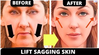 🛑 AGE 35  FACE LIFTING EXERCISES FOR JOWLS and SAGGY SKIN  LAUGH LINES GET RID OF WRINKLES [upl. by Bette-Ann]