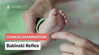 Babinski Reflex in Infants  Clinical Examination [upl. by Nohshan]