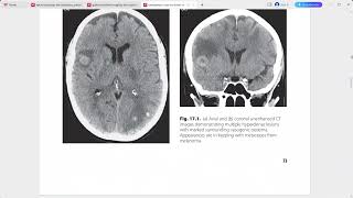 EMERGENCY CROSS SECTIONAL RADIOLOGY [upl. by Nylasej]