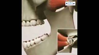 Articulação temporomandibular ATM  DTM  FONOVIM Fonoaudiologia Neurológica [upl. by Gabe]