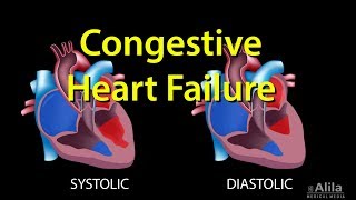 Congestive Heart Failure Leftsided vs Rightsided Systolic vs Diastolic Animation [upl. by Tarra759]