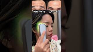 Reduce forehead wrinkles tips forehead wrinkles beautydevice beautyhacks beauty shorts [upl. by Arlee902]