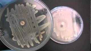 BIO 2192 UNIT 12  Susceptibility to Antibiotics  Novobiocin Sensitivity [upl. by Animsay7]