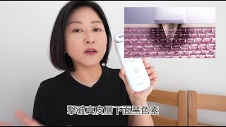 Youtuber Emi 3個月實測🔎去斑醫療美容儀│全韓國香港首部獲韓國醫療協會及食藥署認證的去斑醫療美容儀「Melashot」 [upl. by Natanoj]