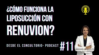 Liposucción con RENUVION Resultados Increíbles y Recuperación Rápida 💫 renuvion cirugiaplastica [upl. by Jd]