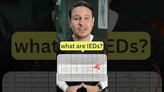 Interictal Epileptiform Discharges on EEG eeg neuroscience epilepsy neurology seizures [upl. by Hameean74]