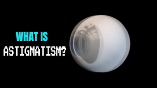 Astigmatism explained [upl. by Assertal497]