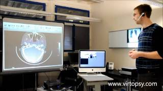 Virtopsy  Potential use of gesture control in medicine using the Microsoft Kinect camera [upl. by Ydne]