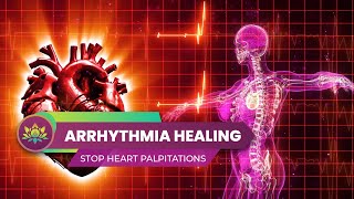 Gentle Healing For Arrhythmia  Stop Heart Palpitations Fatigue amp Anxiety  528 Hz Healing Harmony [upl. by Singleton]