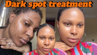 Dark spot treatment these products helped me fade dark spots on my face [upl. by Herald]