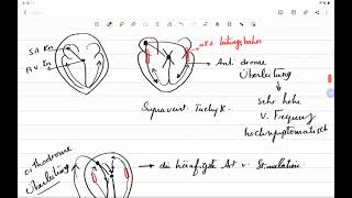 Alles über Wolff Parkinson White Syndrom mit EKGBeispiele [upl. by Lisa344]