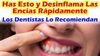 Como Desinflamar Las Encías Rápidamente Con Remedios Para Las Encías Recomendados Por Dentistas [upl. by Hertzfeld]