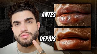 Labios SECOS E RESSECADOS  Como resolver [upl. by Nylesaj548]