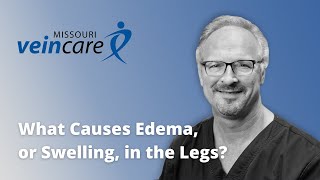 What Causes Edema in My Legs [upl. by Amaj]