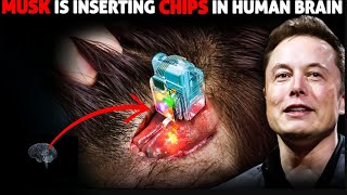 Elon Musks Bold Move  Unveiling Neuralinks Human Brain Implant Trials [upl. by Eaner]