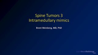 Spine tumors 3 – Intramedullary tumor mimics [upl. by Maurise361]