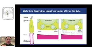 Terapia Genética para pacientes con sordera profunda causada por mutaciones del Gen de Otoferlina [upl. by Luapnoj]