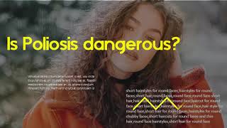 Causes For White Hair Patch Or Poliosis Of Hair Is Poliosis dangerous [upl. by Nalyorf]